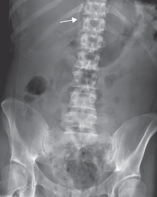 Abdominal pain general